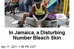 In Jamaica, a Disturbing Number Bleach Skin